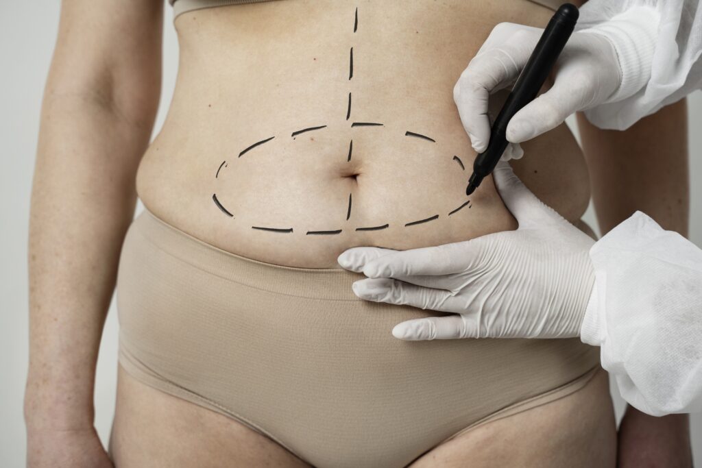 Plastic Surgery in Miami