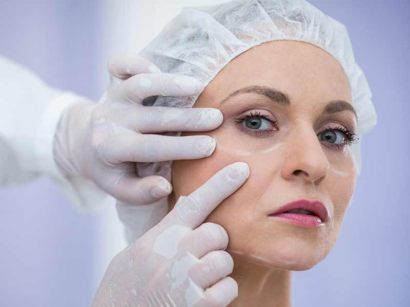 BOTOX injections